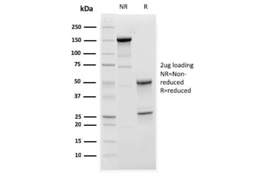 SDS-PAGE - Anti-C1QA Antibody [C1QA/2952] (A250160) - Antibodies.com