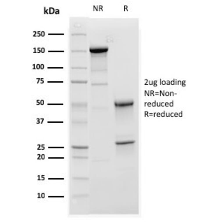 SDS-PAGE - Anti-C1QA Antibody [C1QA/2952] (A250160) - Antibodies.com