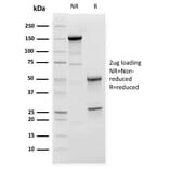 SDS-PAGE - Anti-C1QA Antibody [C1QA/2952] (A250160) - Antibodies.com