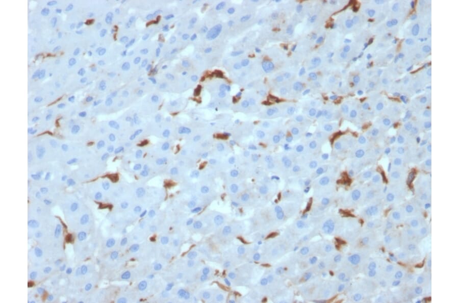 Immunohistochemistry - Anti-C1QA Antibody [C1QA/2953] (A250161) - Antibodies.com