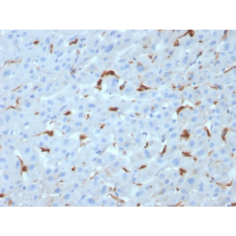 Immunohistochemistry - Anti-C1QA Antibody [C1QA/2953] (A250161) - Antibodies.com