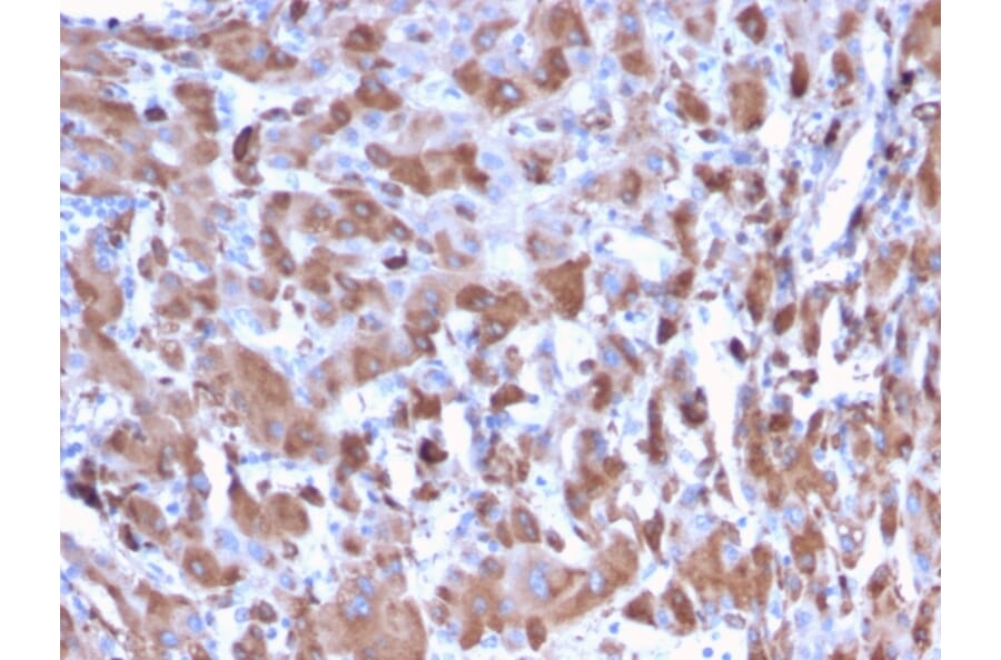 Immunohistochemistry - Anti-C1QA Antibody [C1QA/2953] (A250161) - Antibodies.com
