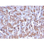 Immunohistochemistry - Anti-C1QA Antibody [C1QA/2953] (A250161) - Antibodies.com