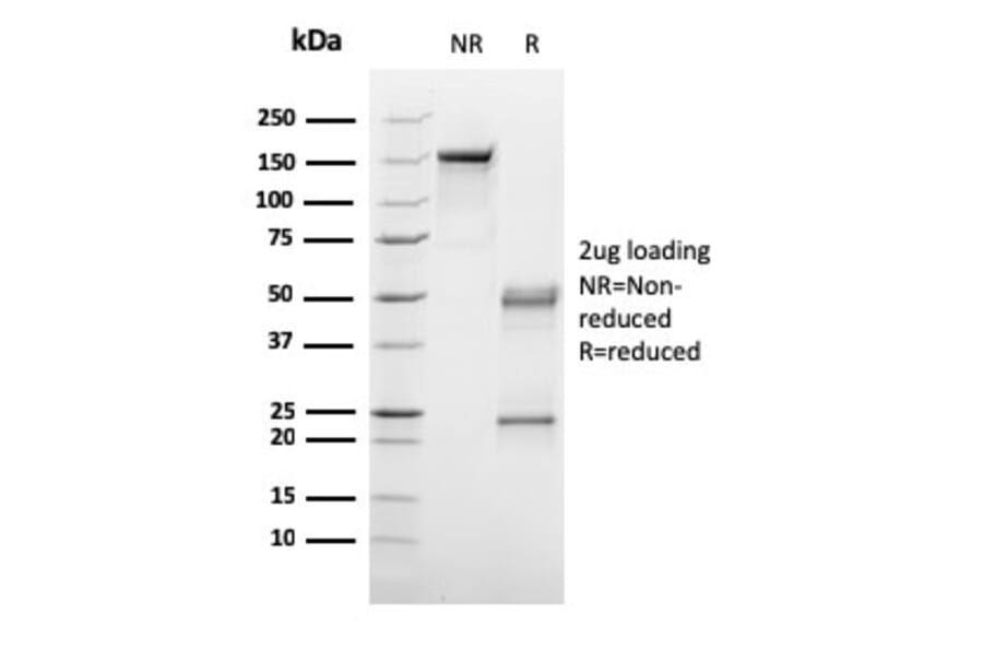 SDS-PAGE - Anti-C1QA Antibody [C1QA/2953] (A250161) - Antibodies.com