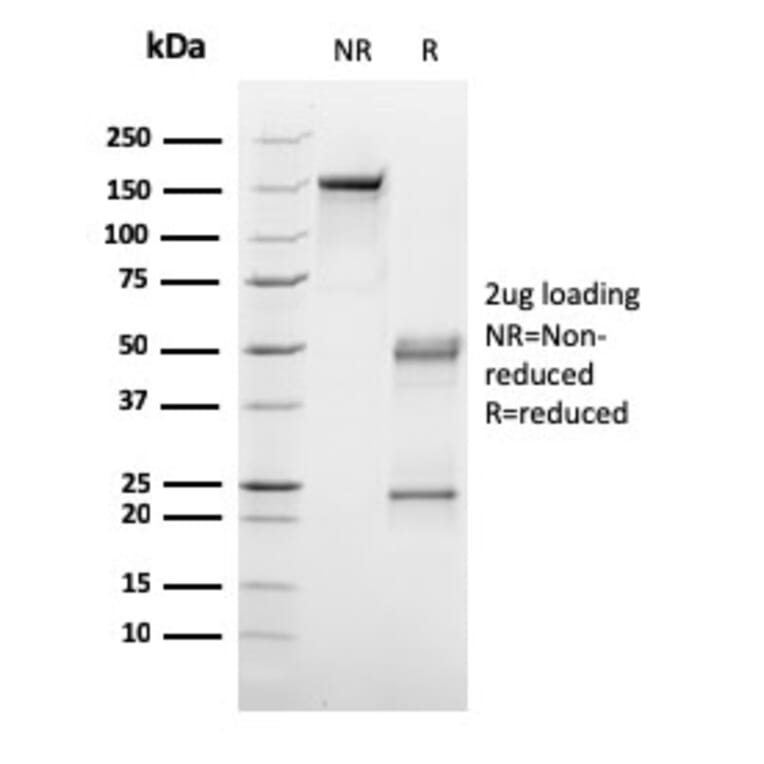 SDS-PAGE - Anti-C1QA Antibody [C1QA/2953] (A250161) - Antibodies.com