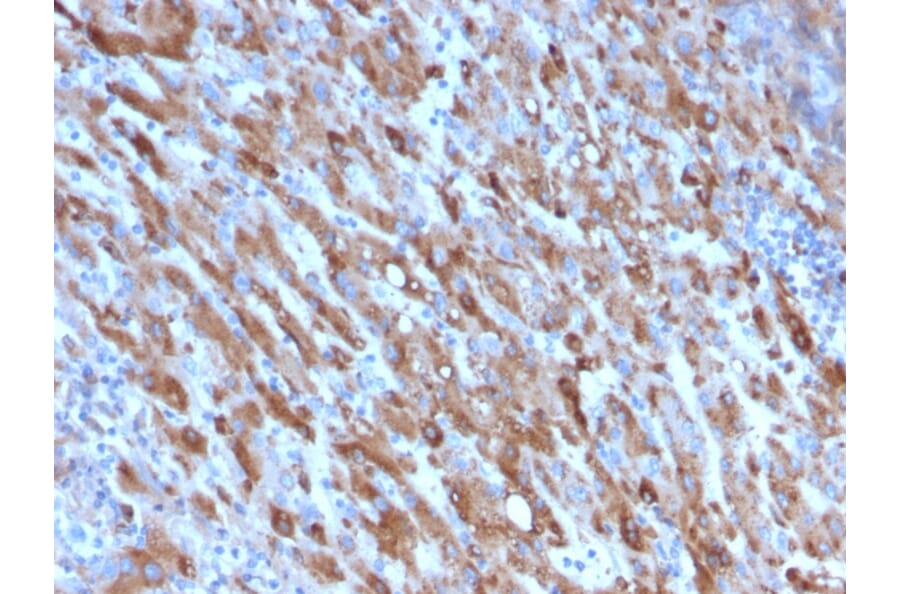 Immunohistochemistry - Anti-C1QA Antibody [C1QA/2954] (A250162) - Antibodies.com