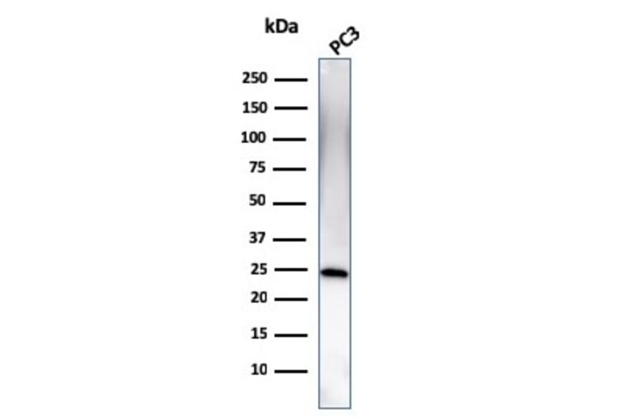 Western Blot - Anti-C1QA Antibody [C1QA/2954] (A250162) - Antibodies.com