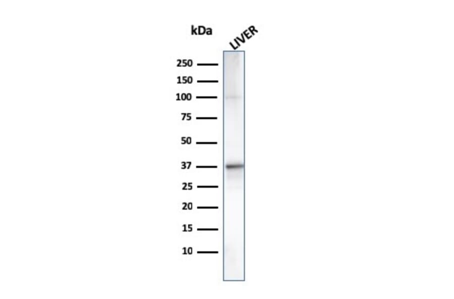 Western Blot - Anti-C1QA Antibody [C1QA/2955] (A250163) - Antibodies.com