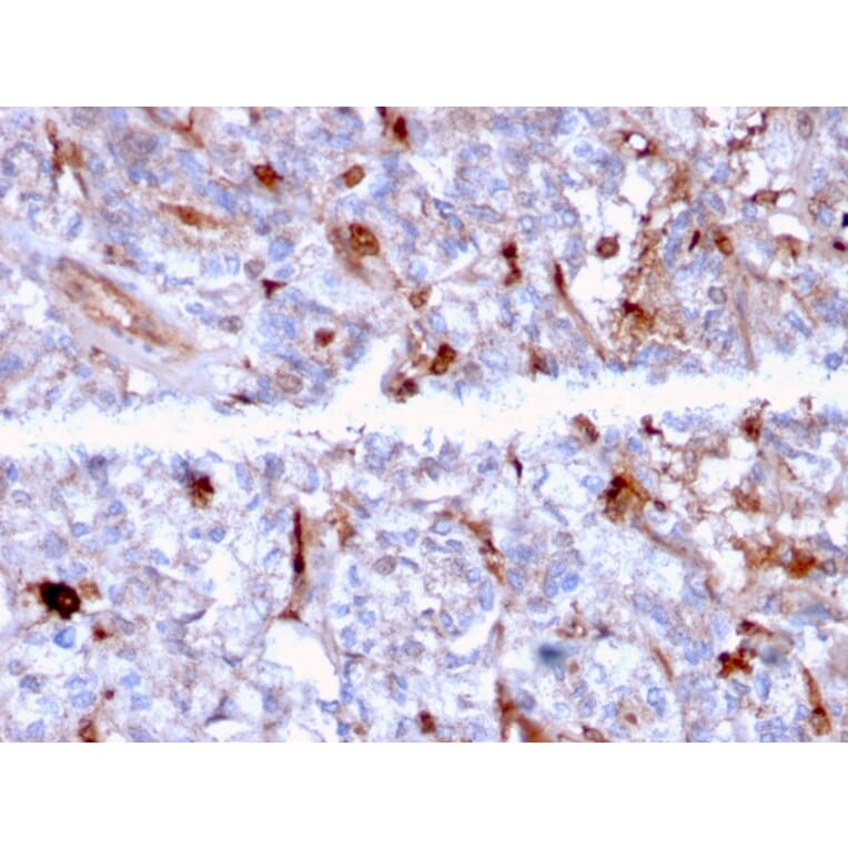 Immunohistochemistry - Anti-C1QA Antibody [C1QA/2956] (A250164) - Antibodies.com