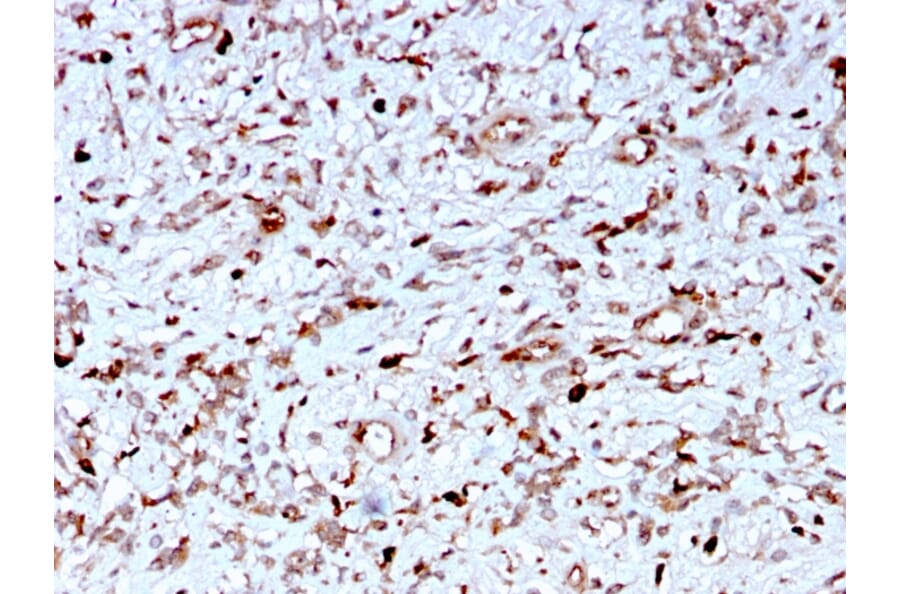 Immunohistochemistry - Anti-C1QA Antibody [C1QA/2956] (A250164) - Antibodies.com