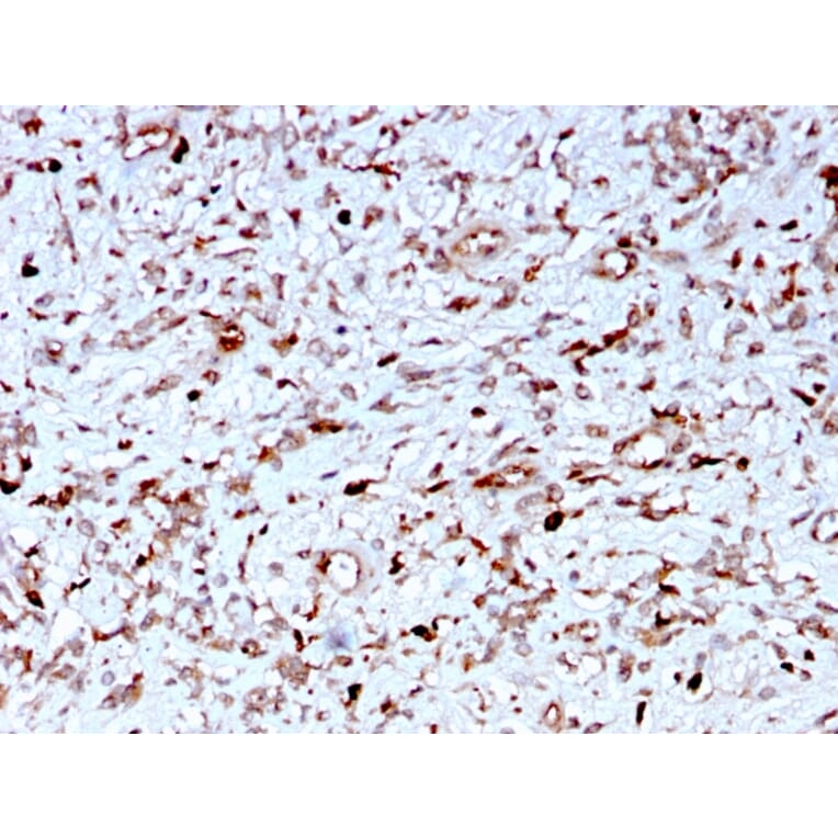 Immunohistochemistry - Anti-C1QA Antibody [C1QA/2956] (A250164) - Antibodies.com