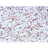 Immunohistochemistry - Anti-C1QA Antibody [C1QA/2956] (A250164) - Antibodies.com