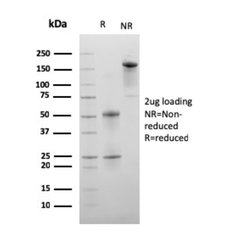 SDS-PAGE - Anti-C1QA Antibody [C1QA/2956] (A250164) - Antibodies.com