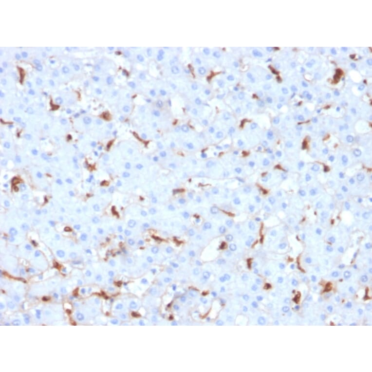 Immunohistochemistry - Anti-C1QB Antibody [C1QB/2961] (A250165) - Antibodies.com