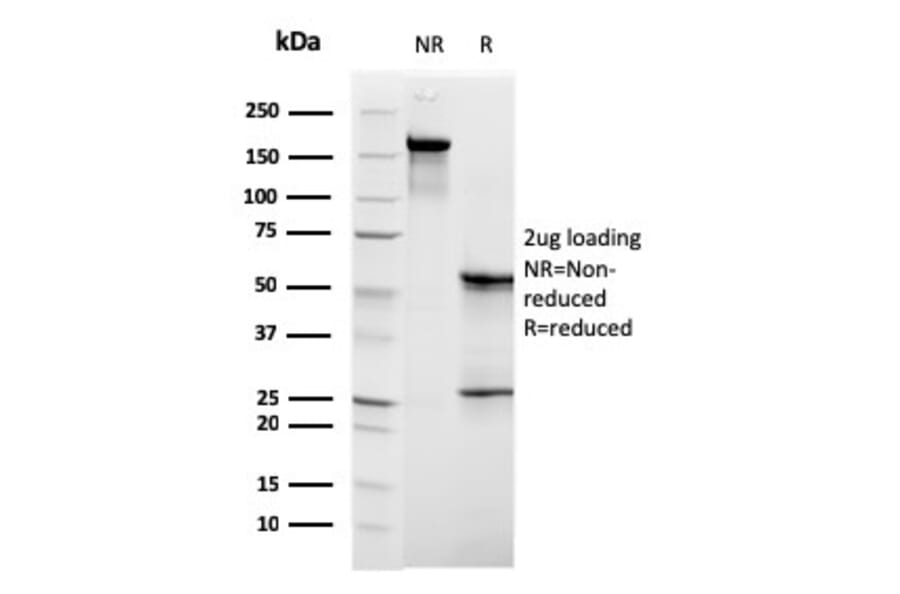 SDS-PAGE - Anti-C1QB Antibody [C1QB/2961] (A250165) - Antibodies.com