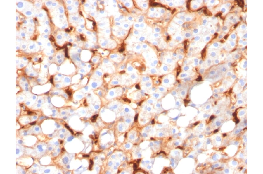 Immunohistochemistry - Anti-C1QB Antibody [C1QB/2966] (A250167) - Antibodies.com