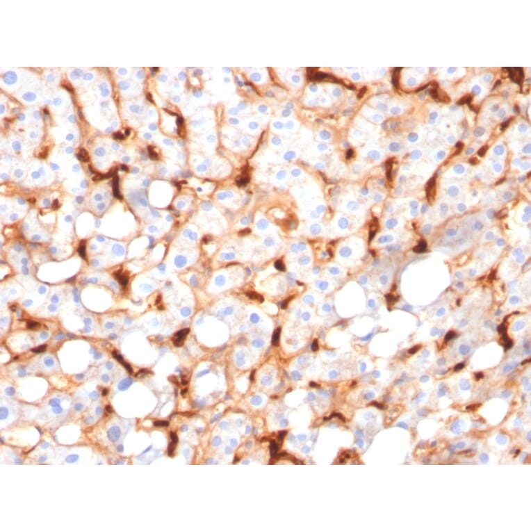 Immunohistochemistry - Anti-C1QB Antibody [C1QB/2966] (A250167) - Antibodies.com