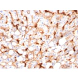 Immunohistochemistry - Anti-C1QB Antibody [C1QB/2966] (A250167) - Antibodies.com