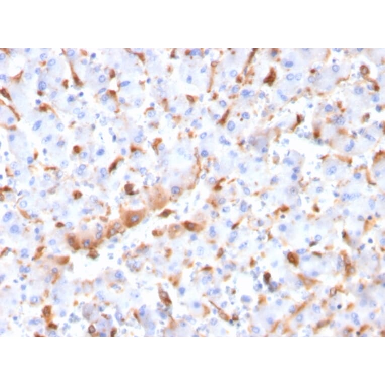 Immunohistochemistry - Anti-C1QB Antibody [C1QB/2966] (A250167) - Antibodies.com