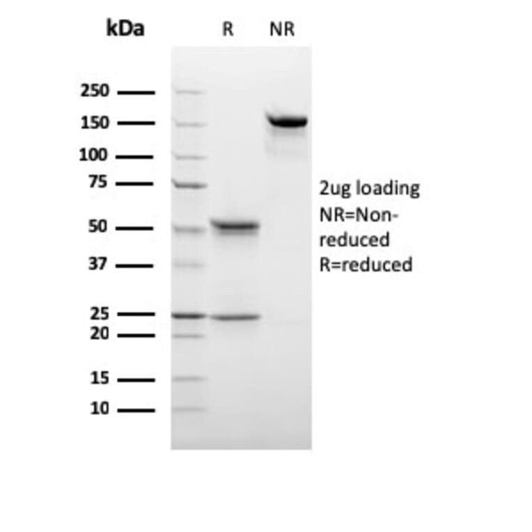 SDS-PAGE - Anti-C1QB Antibody [C1QB/2966] (A250167) - Antibodies.com