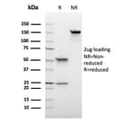 SDS-PAGE - Anti-C1QB Antibody [C1QB/2966] (A250167) - Antibodies.com