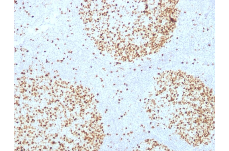 Immunohistochemistry - Anti-Topoisomerase II alpha Antibody [TOP2A/1361] (A250168) - Antibodies.com