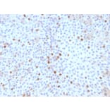 Immunohistochemistry - Anti-Topoisomerase II alpha Antibody [TOP2A/1361] (A250168) - Antibodies.com