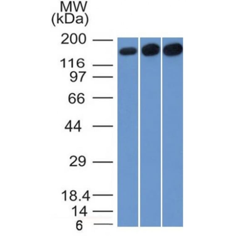 Western Blot - Anti-Topoisomerase II alpha Antibody [TOP2A/1361] (A250168) - Antibodies.com