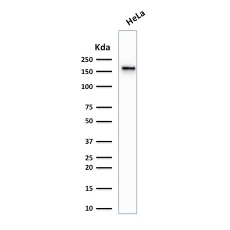 Western Blot - Anti-Topoisomerase II alpha Antibody [TOP2A/1361] (A250168) - Antibodies.com