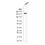 Western Blot - Anti-Topoisomerase II alpha Antibody [TOP2A/1361] (A250168) - Antibodies.com
