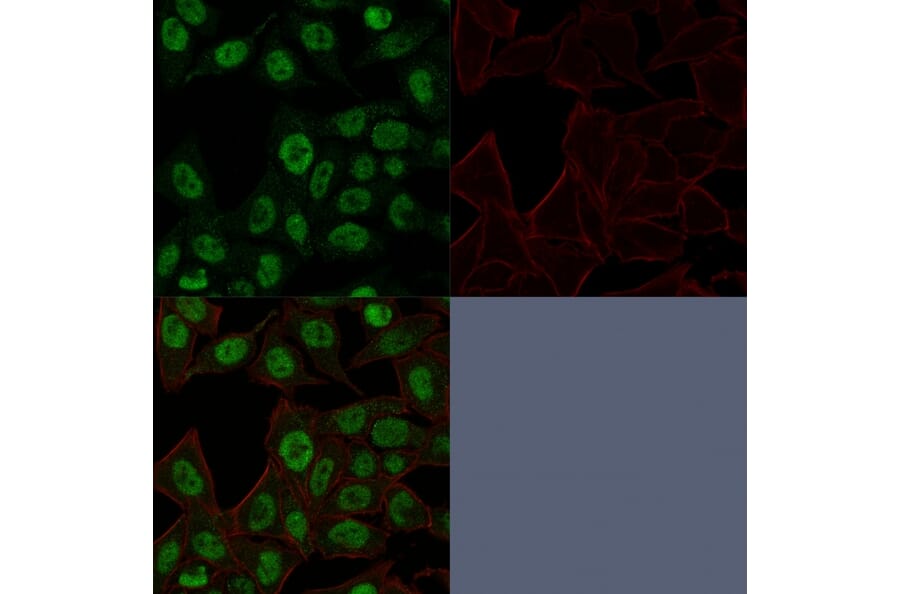 Immunofluorescence - Anti-Topoisomerase II alpha Antibody [TOP2A/1361] (A250168) - Antibodies.com
