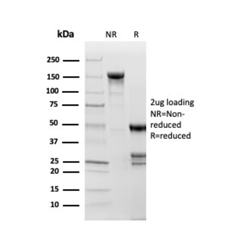 SDS-PAGE - Anti-Topoisomerase II alpha Antibody [TOP2A/1361] (A250168) - Antibodies.com