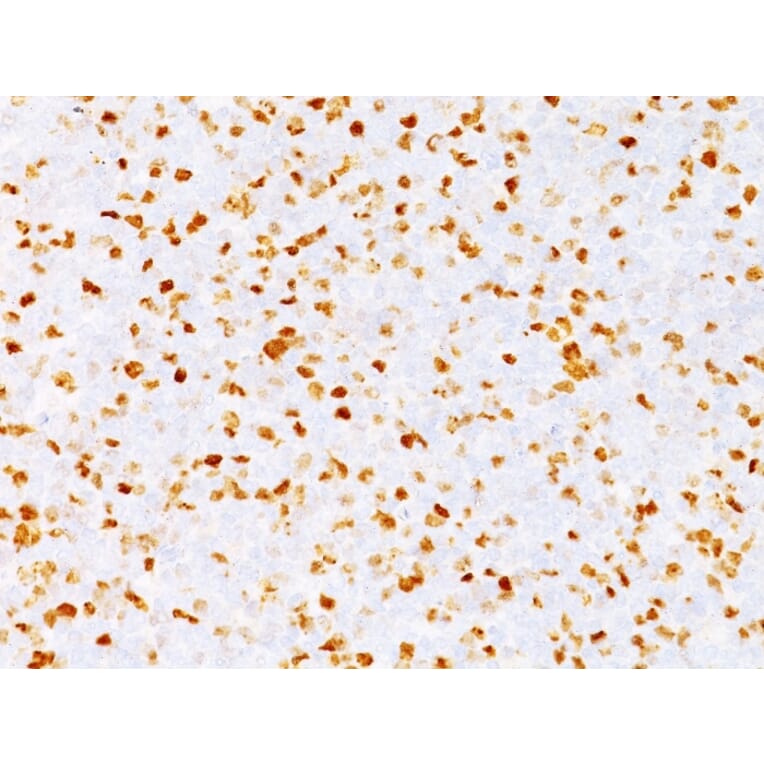 Immunohistochemistry - Anti-Topoisomerase II alpha Antibody [TOP2A/1362] (A250169) - Antibodies.com