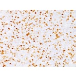 Immunohistochemistry - Anti-Topoisomerase II alpha Antibody [TOP2A/1362] (A250169) - Antibodies.com