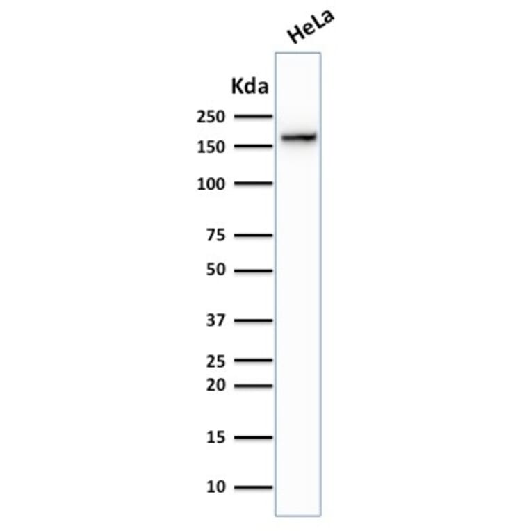 Western Blot - Anti-Topoisomerase II alpha Antibody [TOP2A/1362] (A250169) - Antibodies.com