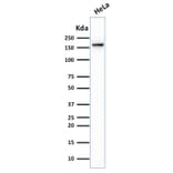 Western Blot - Anti-Topoisomerase II alpha Antibody [TOP2A/1362] (A250169) - Antibodies.com