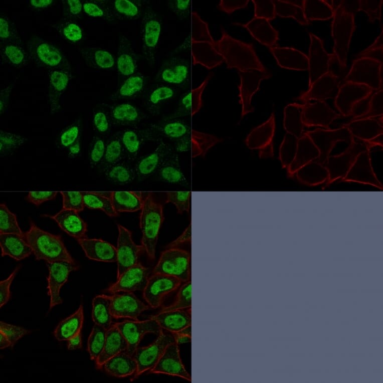 Immunofluorescence - Anti-Topoisomerase II alpha Antibody [TOP2A/1362] (A250169) - Antibodies.com