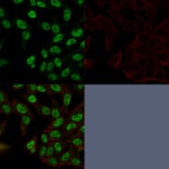 Immunofluorescence - Anti-Topoisomerase II alpha Antibody [TOP2A/1362] (A250169) - Antibodies.com