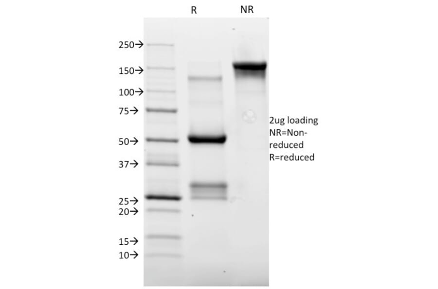SDS-PAGE - Anti-Topoisomerase II alpha Antibody [TOP2A/1362] (A250169) - Antibodies.com