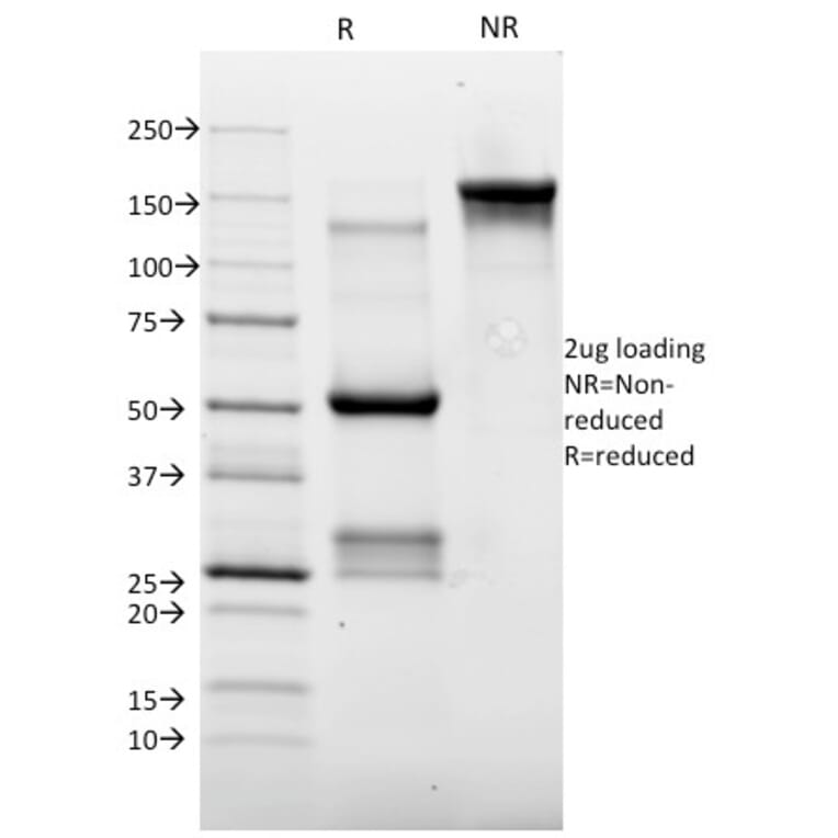 SDS-PAGE - Anti-Topoisomerase II alpha Antibody [TOP2A/1362] (A250169) - Antibodies.com