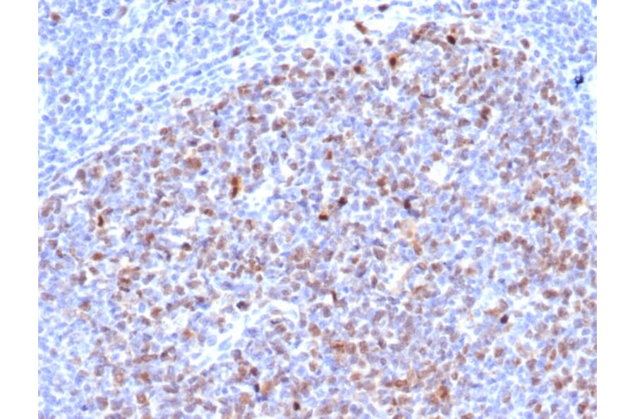 Immunohistochemistry - Anti-Topoisomerase II alpha Antibody [rTOP2A/6629] (A250170) - Antibodies.com