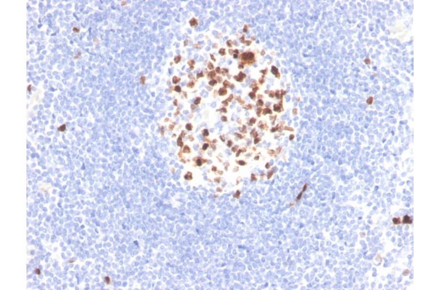 Immunohistochemistry - Anti-Topoisomerase II alpha Antibody [rTOP2A/6629] (A250169) - Antibodies.com