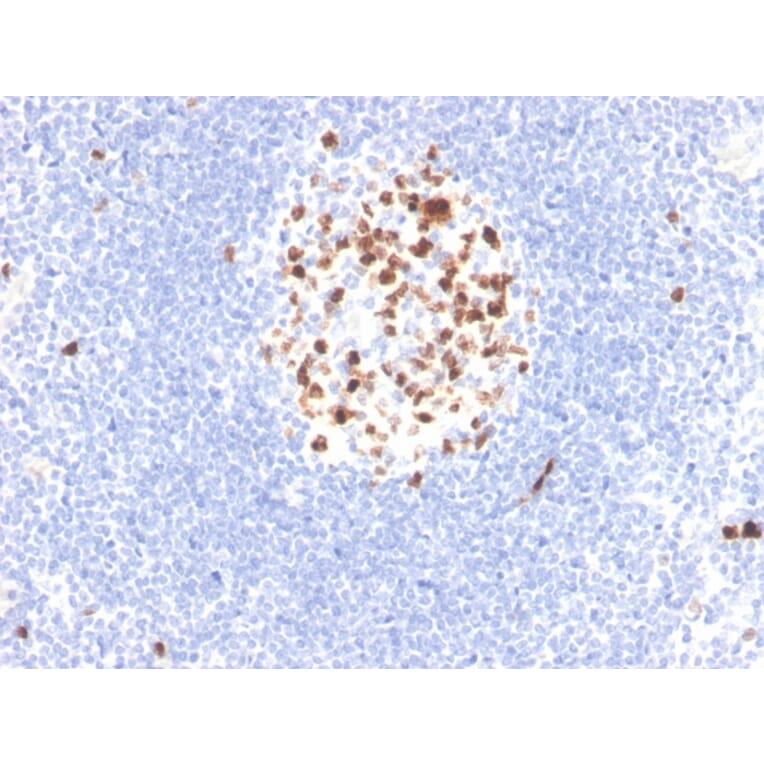 Immunohistochemistry - Anti-Topoisomerase II alpha Antibody [rTOP2A/6629] (A250169) - Antibodies.com