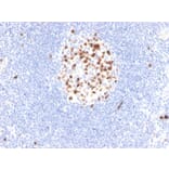 Immunohistochemistry - Anti-Topoisomerase II alpha Antibody [rTOP2A/6629] (A250169) - Antibodies.com