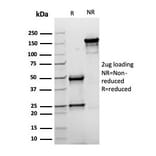 SDS-PAGE - Anti-Topoisomerase II alpha Antibody [rTOP2A/6629] (A250170) - Antibodies.com