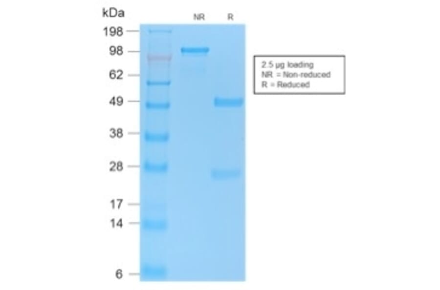 SDS-PAGE - Anti-p53 Antibody [PAb1801] (A250172) - Antibodies.com