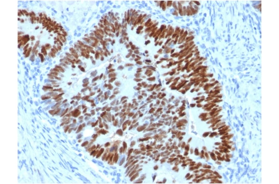 Immunohistochemistry - Anti-p53 Antibody [PCRP-TP53-2A10] (A253354) - Antibodies.com