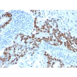 Immunohistochemistry - Anti-p53 Antibody [PCRP-TP53-1F7] (A253352) - Antibodies.com