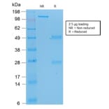 SDS-PAGE - Anti-p53 Antibody [rBP53-12] (A250176) - Antibodies.com