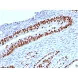 Immunohistochemistry - Anti-p53 Antibody [TP53/2719] (A250176) - Antibodies.com